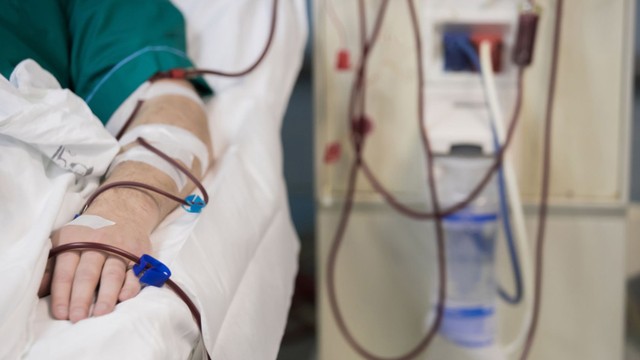 bai-viet/loc-mau-lien-tuc-la-gi-uu-diem-va-han-che-cua-loc-mau-lien-tuc.html