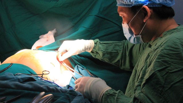 bai-viet/lom-nguc-co-phai-mo-khong-60366.html