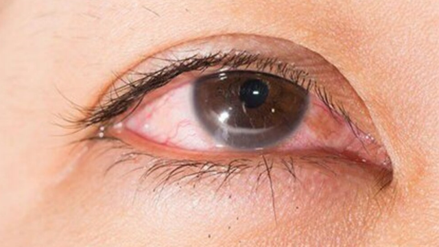 bai-viet/mach-ban-mot-so-meo-chua-long-quam.html