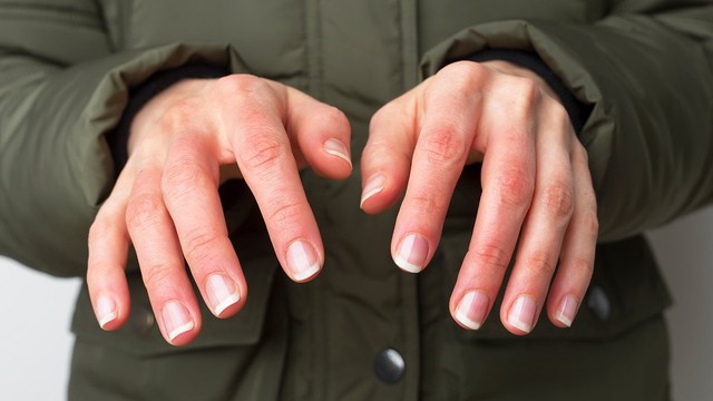 bai-viet/luu-lai-ngay-cach-so-cuu-bong-lanh-ai-cung-nen-biet.html