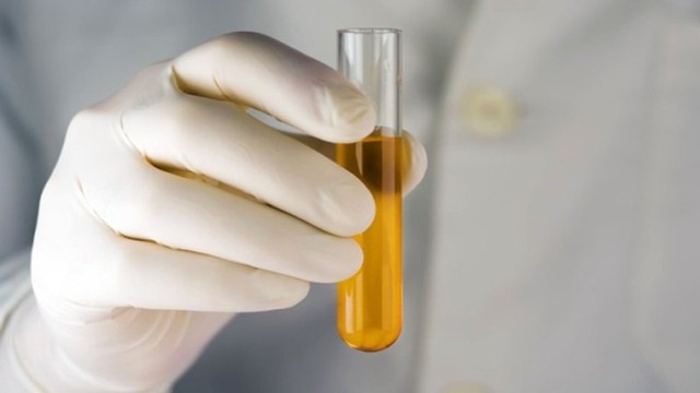 bai-viet/ly-giai-hien-tuong-sang-ngu-day-nuoc-tieu-vang-dam-65657.html