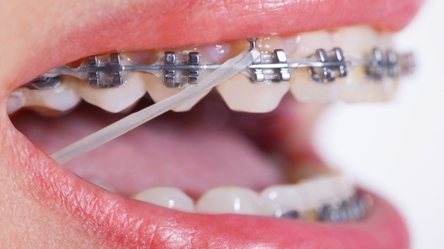 bai-viet/mac-cai-thuong-co-uu-diem-va-han-che-gi-co-nen-dung-mac-cai-thuong-khong.html