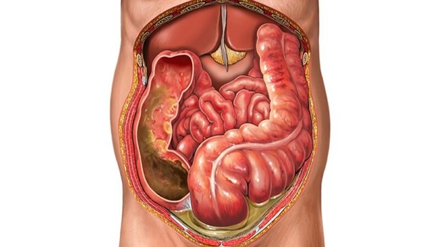 bai-viet/mac-noi-nho-la-gi-va-lay-mac-noi-nho-duoc-chi-dinh-trong-truong-hop-nao.html