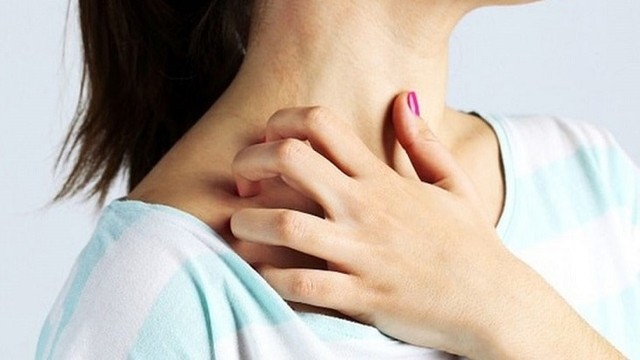 bai-viet/mach-ban-cach-dieu-tri-me-day-man-ngua-sau-sinh-54519.html