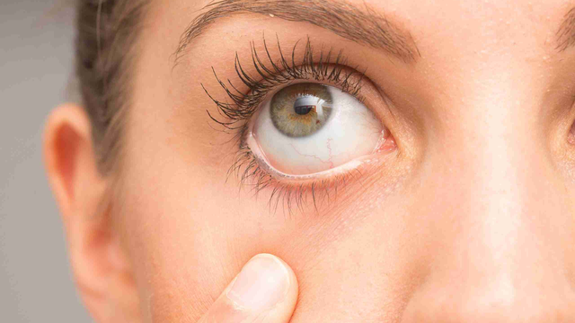 bai-viet/mach-ban-cach-don-giai-giup-cai-thien-tinh-trang-kho-moi-mat.html