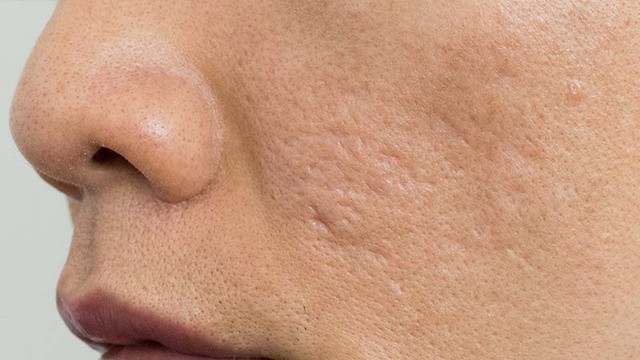 bai-viet/mach-ban-phuong-phap-tri-seo-ro-bang-nha-dam.html