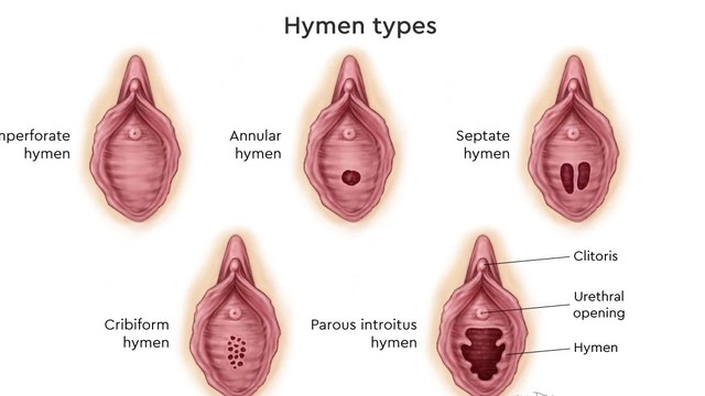 bai-viet/mang-trinh-khong-thung-nguyen-nhan-phuong-phap-dieu-tri-va-phong-ngua.html