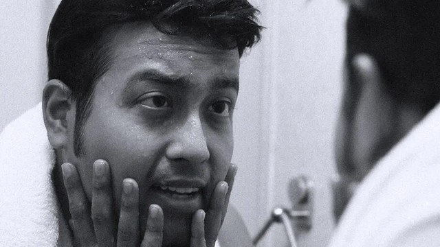 bai-viet/mat-bi-sung-phu-canh-bao-benh-ly-gi-nguyen-nhan-va-cach-dieu-tri-hieu-qua.html