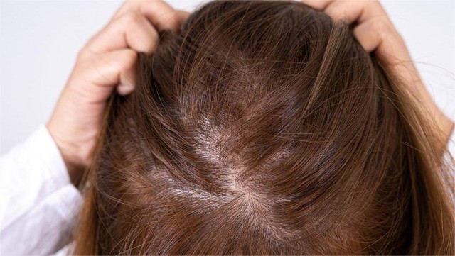 bai-viet/mat-do-toc-la-gi-mot-so-bien-phap-giup-cai-thien-mat-do-toc-tai-nha.html