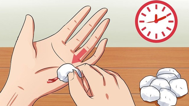 bai-viet/mau-loang-la-nhom-mau-gi-co-dieu-tri-dut-diem-duoc-khong-64913.html