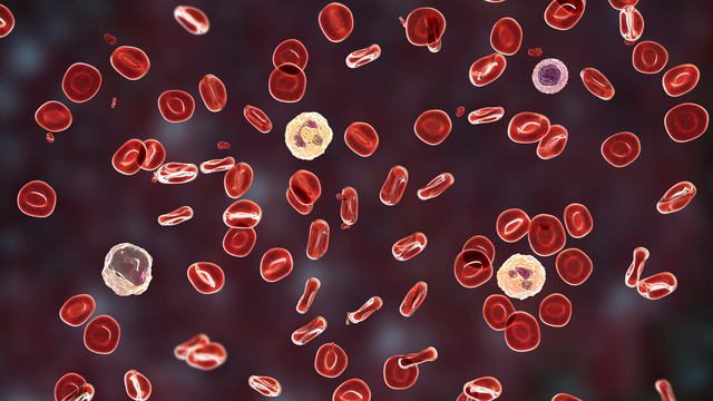 bai-viet/mau-mau-bi-vo-hong-cau-anh-huong-nhu-the-nao-den-ket-qua-xet-nghiem.html