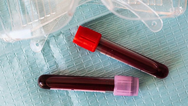 bai-viet/mau-nhan-tao-tuong-lai-cua-nganh-y-te-va-nhung-tiem-nang-chua-duoc-khai-thac.html