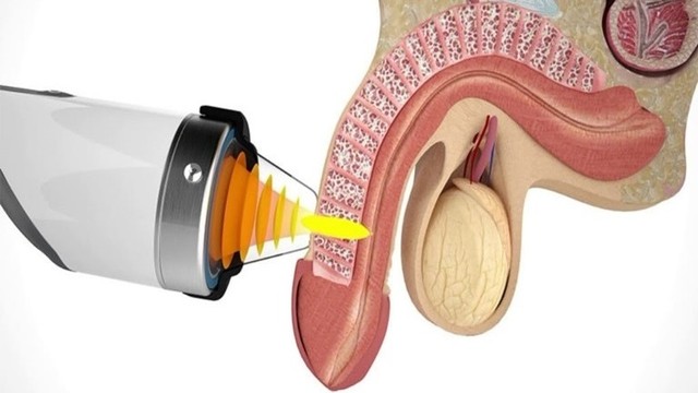 bai-viet/may-chua-roi-loan-cuong-duong-bang-song-xung-kich-co-hieu-qua-khong.html