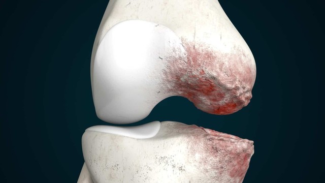 bai-viet/may-mat-xa-dau-goi-fuji-pg-2015-f3-ho-tro-xoa-diu-con-dau-that-co-goi.html