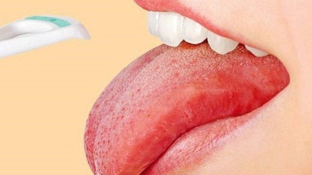 bai-viet/meo-chua-rat-luoi-don-gian-va-hieu-qua-tai-nha.html