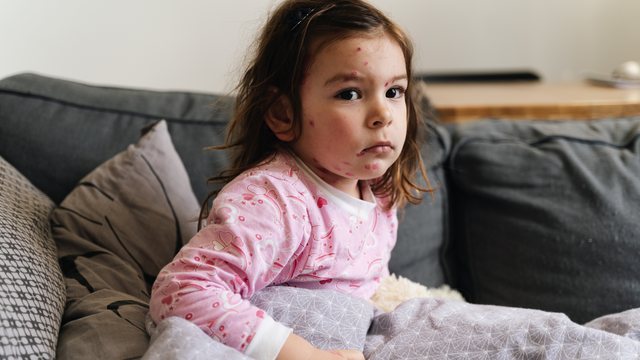 bai-viet/me-bi-thuy-dau-co-lay-nhiem-cho-be-khong-bien-phap-phong-ngua-lay-nhiem.html