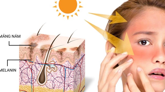 bai-viet/melanin-la-gi-co-che-hinh-thanh-melanin-50768.html