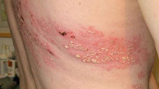 bai-viet/meo-dan-gian-chua-gioi-leo-bang-dau-xanh-cuc-nhanh-khoi-35897.html