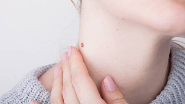 bai-viet/tim-hieu-ve-mun-coc-va-mieng-dan-kangdi-fobelife.html