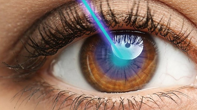 bai-viet/mo-mat-can-smile-pro-la-gi-co-nguy-hiem-khong.html