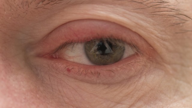 bai-viet/mo-tac-tuyen-le-phuong-phap-hieu-qua-va-nhung-dieu-can-biet.html