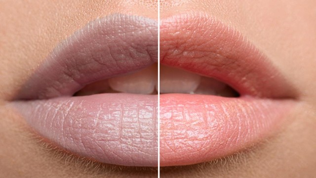 bai-viet/nguyen-nhan-gay-moi-tham-va-mot-so-cach-lam-hong-moi-hieu-qua-tai-nha.html