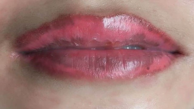 bai-viet/nguyen-nhan-moi-tham-loang-sau-phun-moi-va-cach-khac-phuc.html