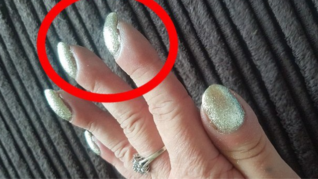 bai-viet/mong-tay-cong-xuong-la-dau-hieu-cua-benh-gi-trieu-chung-o-mong-tay-khong-nen-bo-qua.html