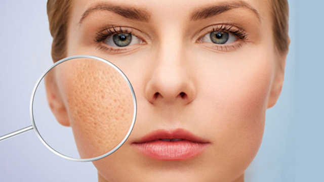 bai-viet/lieu-trinh-tri-seo-ro-bao-lau-thoi-gian-phuong-phap-va-cach-cham-soc-da-hieu-qua.html