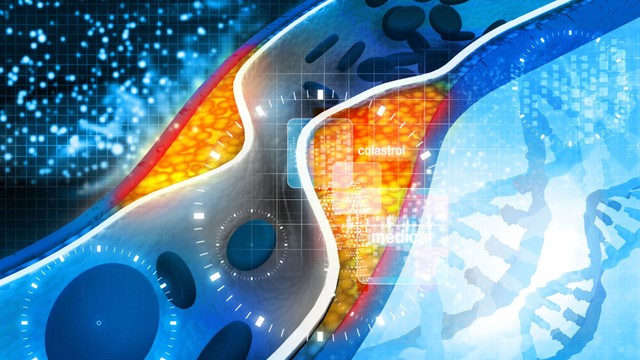 bai-viet/mot-mui-tiem-de-giam-cholesterol-suot-doi-cac-nha-khoa-hoc-mo-ra-lieu-phap-gen-dot-pha.html