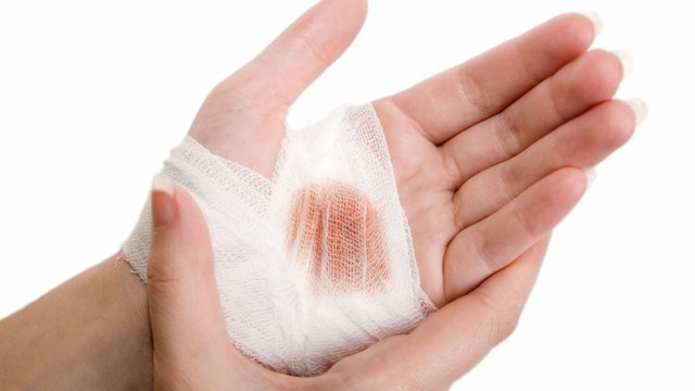 bai-viet/mot-so-luu-y-can-biet-khi-cham-soc-vet-thuong-ho-tai-nha-57178.html