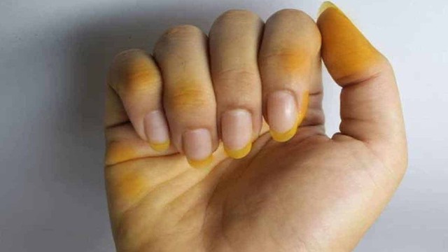 bai-viet/mot-vai-cach-rua-sach-nghe-tren-mong-tay-hieu-qua.html