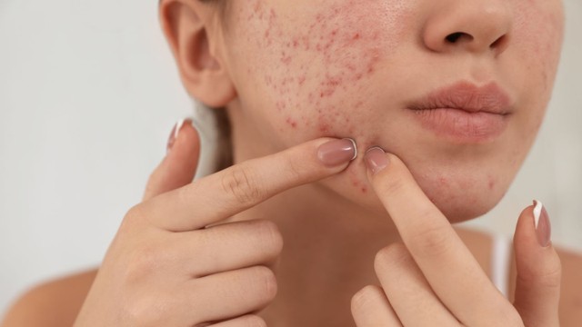 bai-viet/mun-an-sung-do-nguyen-nhan-va-cach-dieu-tri.html