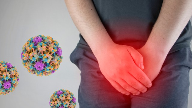 benh/mun-com-sinh-duc-487.html