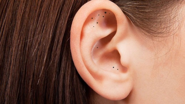 bai-viet/mun-dau-den-trong-lo-tai-co-sao-khong-co-nen-nan-mun-dau-den-khong.html