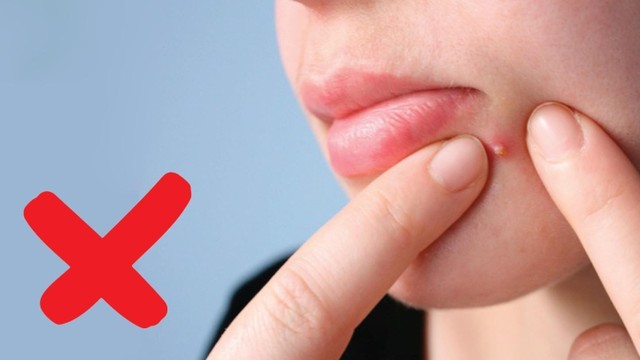 bai-viet/mun-viem-co-nen-nan-khong-cach-cham-soc-da-bi-mun-viem-ngay-tai-nha.html