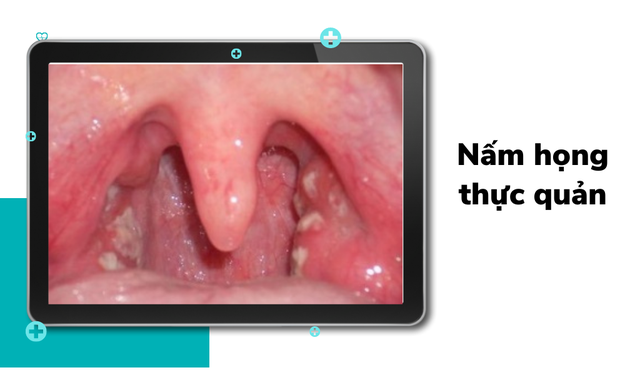 bai-viet/nam-hong-thuc-quan-va-nhung-dieu-can-biet-55639.html