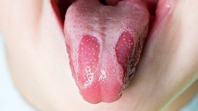 bai-viet/top-4-thuoc-tri-nam-luoi-hieu-qua-va-an-toan-ban-nen-biet.html