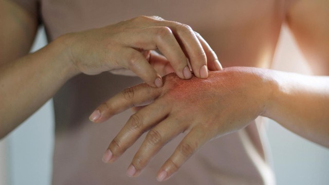 bai-viet/top-5-thuoc-boi-ngoai-da-dieu-tri-nam-hieu-qua-ma-ban-nen-biet.html