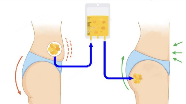 bai-viet/nang-mong-bang-mo-tu-than-co-an-toan-khong-giu-duoc-bao-lau.html