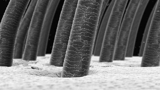 bai-viet/nang-toc-la-gi-nguyen-nhan-nang-toc-chet-va-cach-khac-phuc-71475.html