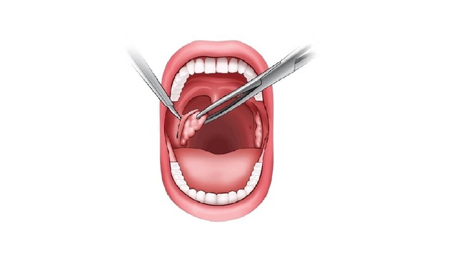 bai-viet/nao-va-bao-nhieu-tien-khi-nao-can-nao-va.html