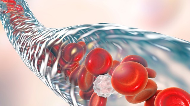 bai-viet/nen-an-gi-de-chong-tut-bach-cau-trong-qua-trinh-hoa-tri.html