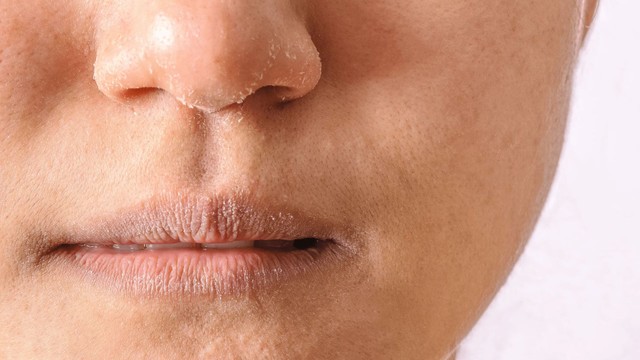 bai-viet/nen-chon-vitamin-va-khoang-chat-gi-de-cai-thien-tinh-trang-da-kho.html