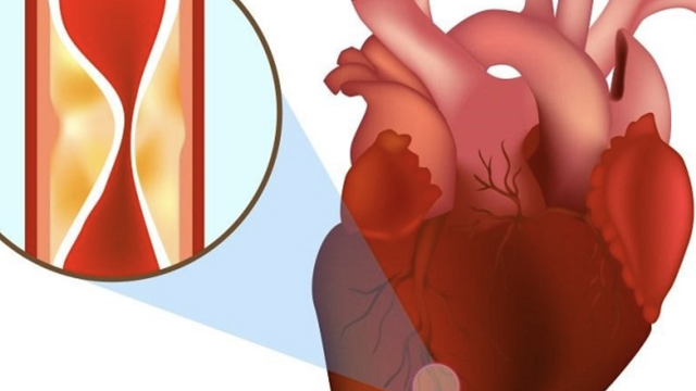 bai-viet/dieu-tri-nhoi-mau-co-tim-o-dau-tot-nhat-tieu-chi-lua-chon-noi-kham-va-dieu-tri-nhoi-mau-co-tim.html