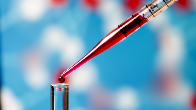 bai-viet/tim-hieu-ve-nghiem-phap-coombs-va-vai-tro-trong-y-hoc.html