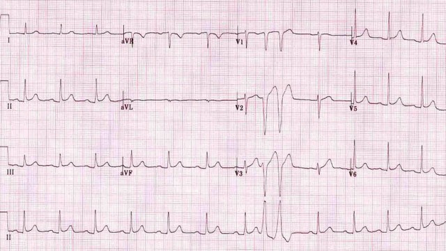 bai-viet/ngoai-tam-thu-that-nhip-3-nguyen-nhan-trieu-chung-va-bien-phap-phong-ngua.html