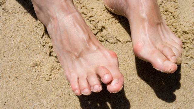 benh/ngon-chan-hinh-bua.html