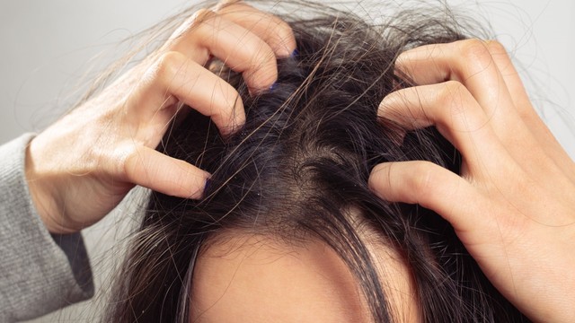 bai-viet/ngua-da-dau-rung-nhieu-toc-nguyen-nhan-va-cach-chua.html