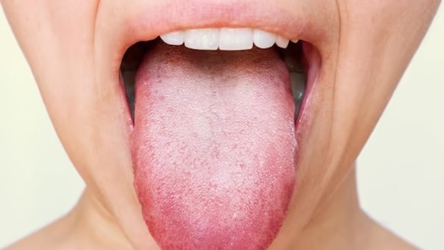 bai-viet/ngua-luoi-trieu-chung-noi-len-suc-khoe-khong-on-dinh-cua-ban.html